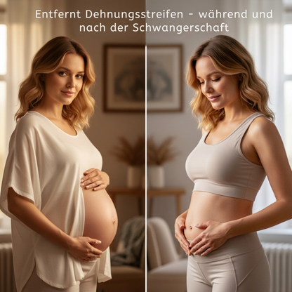 Nalaya – Schwangerschaftsbauchöl gegen Dehnungsstreifen