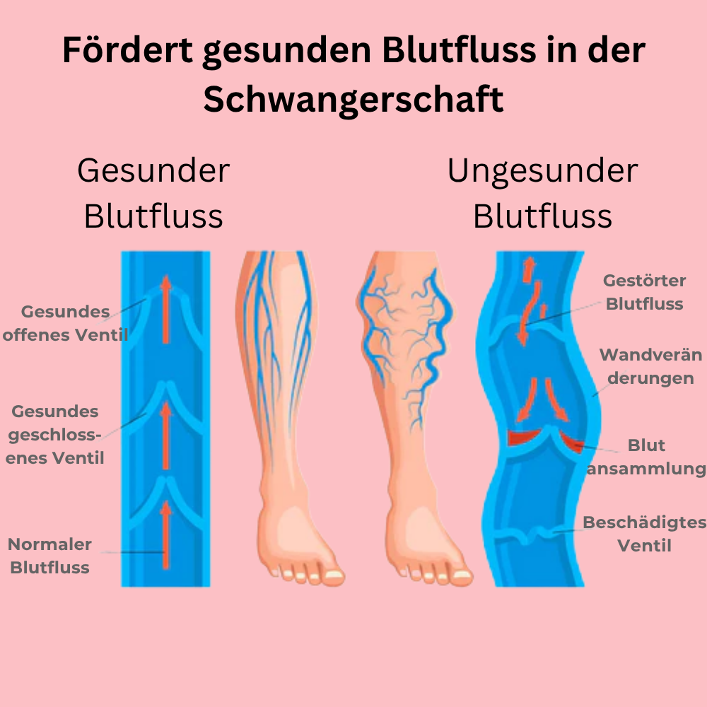 Nalaya - Schwangerschafts-Kompressionsstrümpfe